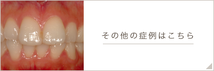 その他の症例はこちら